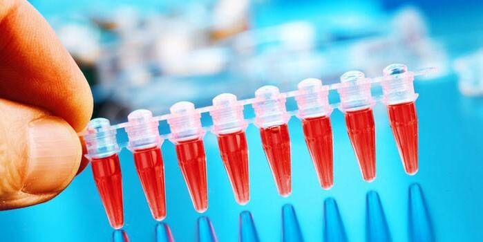 Krvni test za ugotavljanje prisotnosti parazitov v črevesju