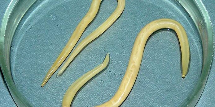 Človeški okrogli črvi v petrijevki - parazitirajo na stenah tankega črevesa