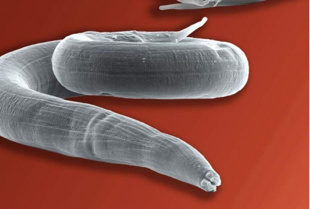 pinworm iz človeškega telesa