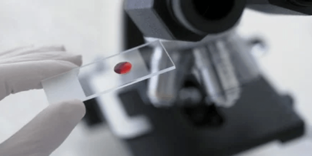 Krvni test